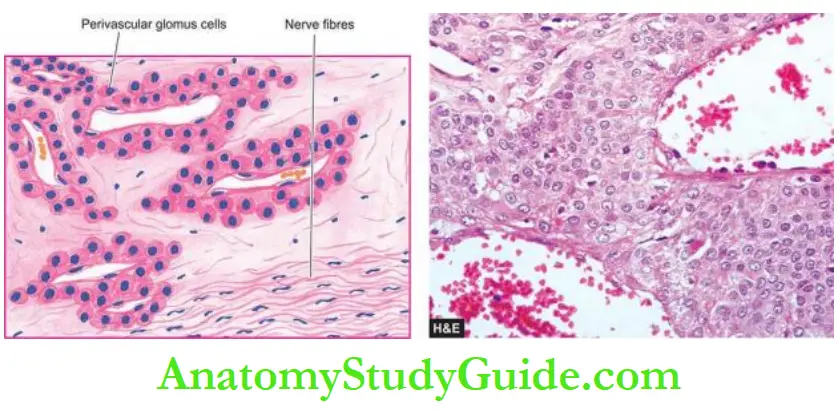Blood Vessels And Lymphatics Glomus tumour