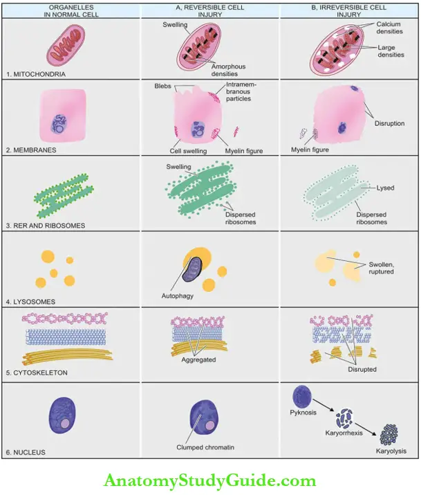 Cellular Processes In Pathogenesis Of Injury - Anatomy Study Guide