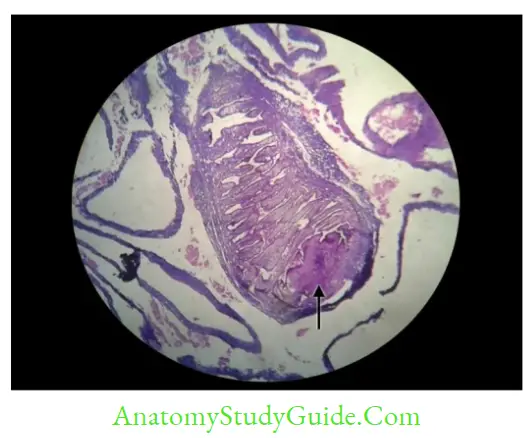 Cestodes And Trematodes Notes - Anatomy Study Guide