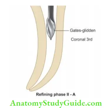 Cleaning And Shaping Of Root Canal System Coronal part of the canal is flred using Gates-glidden drills.