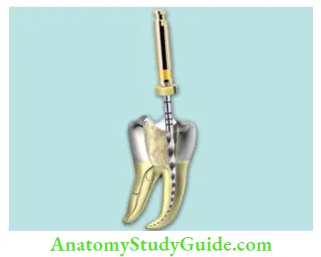Cleaning And Shaping Of Root Canal System Master apical fie should feel smooth in a well prepared canal.