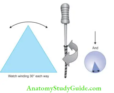 Cleaning And Shaping Of Root Canal System Watch-winding motion; Rotation of file in watch-winding motion.