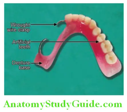 Components Of Acrylic Partial And Cast Partial Denture acrylic partial denture