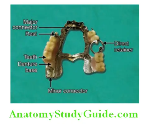 Components Of Acrylic Partial And Cast Partial Denture cast partial denture