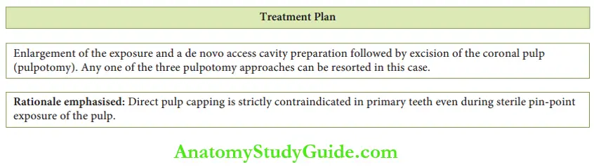 Conservative Endodontic Therapy In Primary Teeth Treatment Plan