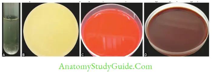 Culture Media and Methods, Identification of Bacteria by Conventional,Automated and Molecular Methods A. Peptone water; B. Nutrient agar C. Blood agar D. Chocolate agar