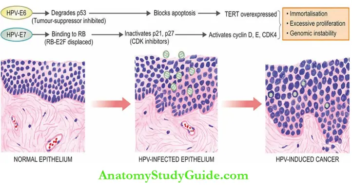 DNA Oncogenic Viruses Oncogenesis By High Risk HPVs