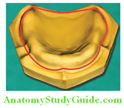 Dental Cast anatomical portion of the cast