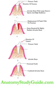 Traumatic Dental Injuries in Primary Dentition Notes - Anatomy Study Guide