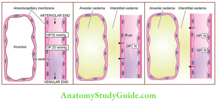 Derangements Of Homeostasis And Haemodynamics Mechanisms Involved In The Pathogenesis Of Pulmonary Oedema
