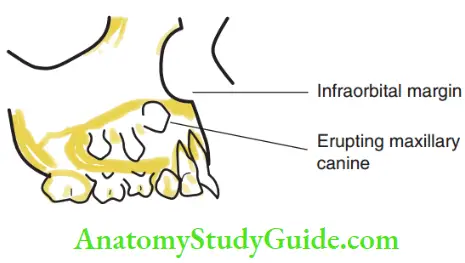 Development Of Occlusion Canine Tooth Buds Are Present Near The Ibfraorbital Rim, Making The Course Of Its mnEruption The Longest