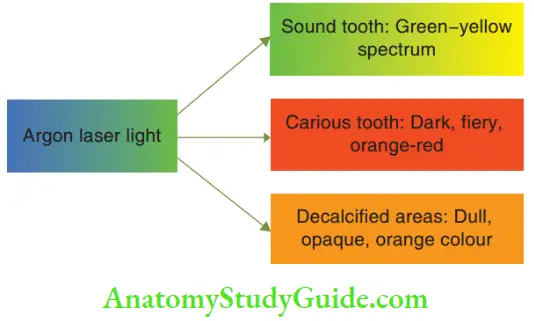 Diagnosis And Removal Of Dental Caries Argon Light Illumination On A Decayed Tooth