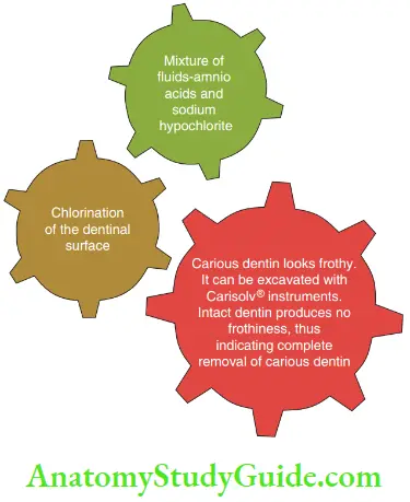 Diagnosis And Removal Of Dental Caries Carisolv System