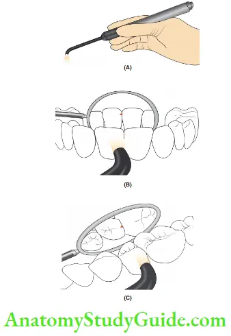 Diagnosis And Removal Of Dental Caries FOTI Equipment And Its Usage In Detection Of Caries