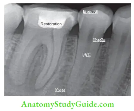 Diagnostic Procedures Notes enamel, dentin, pulp, restoration and alveolar bone