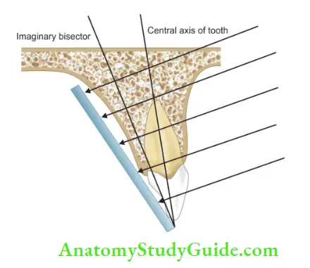 Diagnostic Procedures Notes recording plane of X-ray fim and the long axis of the tooth.