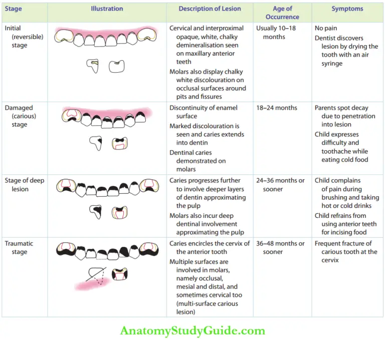 Early Childhood Caries Notes - Anatomy Study Guide