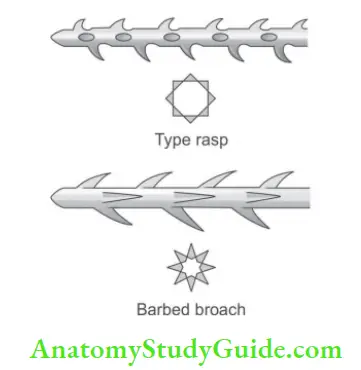 Endodontic Instruments Schematic representation of rasp and barbed broach.