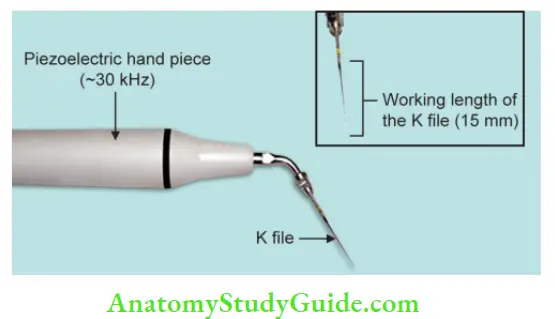 Endodontic Instruments Ultrasonic handpiece with attached K-File.