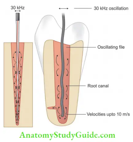 Endodontic Instruments oscillating ultrasonic file and flid movement in the canal.