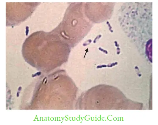 Enterobacteriaceae Wayson staining demonstrates bipolar appearance of Yersinia pestis (arrow showing)
