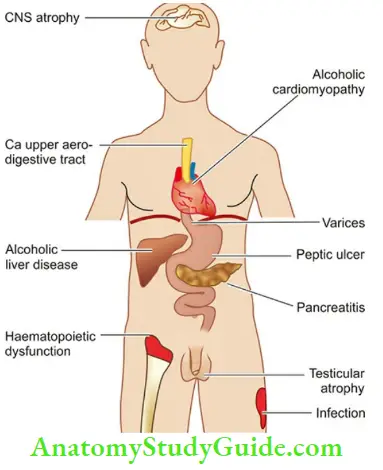 Environmental Diseases Complications Of Chronic Alcoholism