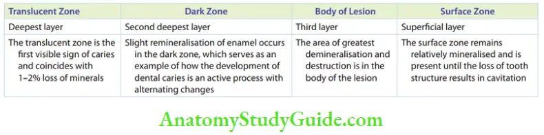 Essentials Of Dental Caries Four Zones Of Enamel Caries