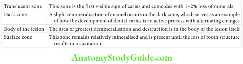 Essentials Of Dental Caries The Zones In Enamel Caries