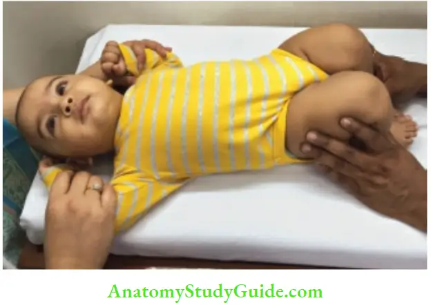 Examination Of A Newborn Baby Galeazzi Test