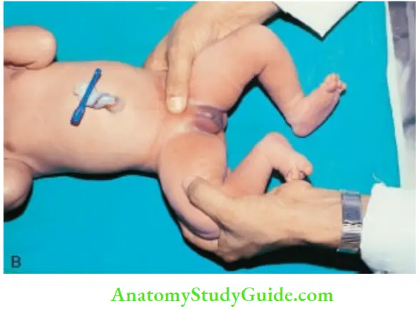 Examination Of A Newborn Baby The Role Of Examiners Hands IS Revered