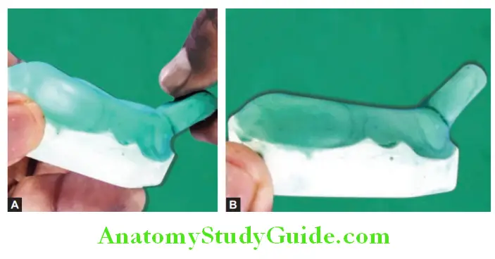 Fabrication Of Custom Tray On Maxillary And Mandibular Primary Casts handle is attaches at 45° angularion in anterior part of maxillary cuatom tray