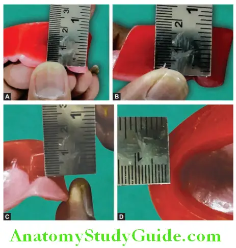 Fabrication Of Occlusal Rims anterior heoght 20-22 mm in canine region and posterior height 18 mm in molar region from border of record base