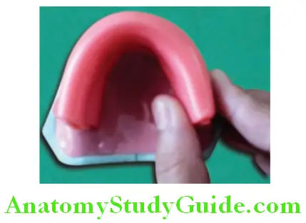 Fabrication Of Occlusal Rims extend the wax till the borders of record base index finger and thumb