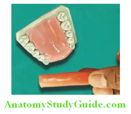 Fabrication Of Removable Partial Denture make wax roll of modeling wax