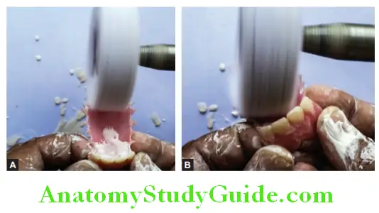 Fabrication Of Removable Partial Denture polishing of maxillary and mandibular partial denture