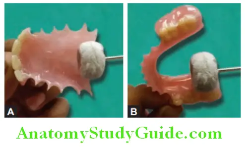 Fabrication Of Removable Partial Denture use clean cotton buff or rag wheel to clean pumice from surface and give final luster