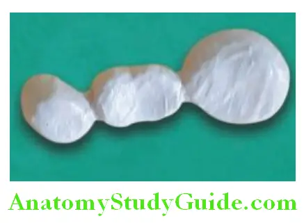 Fabrication Of Three Unit Fixed Partial Denture application of dentine and enamel layer porcelain