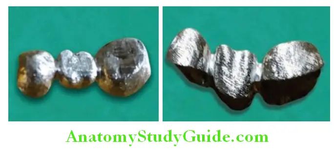 Fabrication Of Three Unit Fixed Partial Denture cleaning of casting removal of investment material from all surfaces