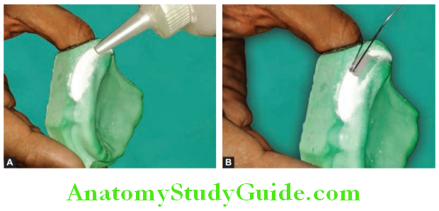 Fabrication of Denture Base Record Base application of polymer and saturating it with monomer