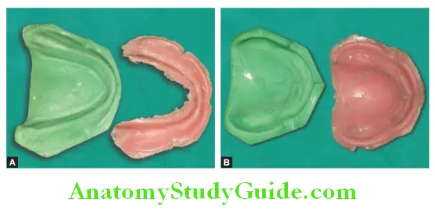 Fabrication of Denture Base Record Base retrieve the record base after plymerization