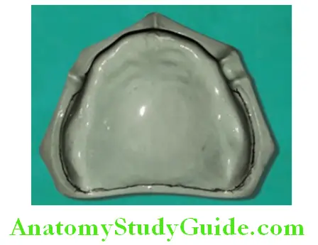 Fabrication of Denture Base Record Base soak the cast in sleey water