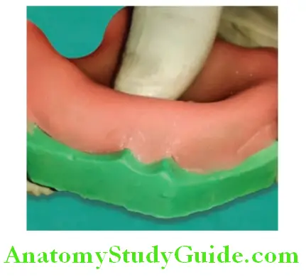 Fabrication of Denture Base Record Base take care to cover sulcus properly the tickness should be maintained
