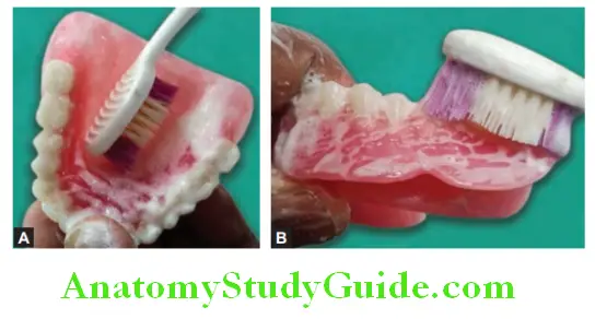Finishing And Polishing Of Complete Denture removal of any reside of polishing agent soap water
