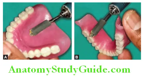 Finishing And Polishing Of Complete Denture use of emery paper for final finishing