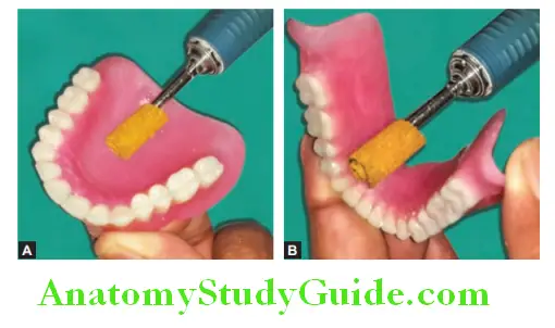 Finishing And Polishing Of Complete Denture use of sand paper for finishing of dentures