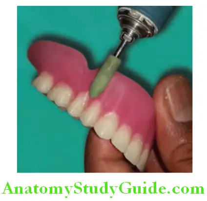 Finishing And Polishing Of Complete Denture use rubber point to remove scratches
