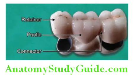 Fixed Partial Denture parts of fixed partial denture