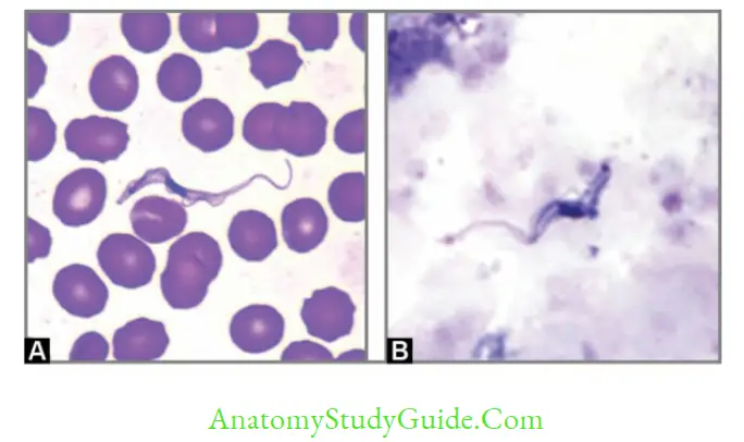Flagellates Trypomastigote form of T. brucei in peripheral blood smear examination (Giemsa stain)A. Thin smear