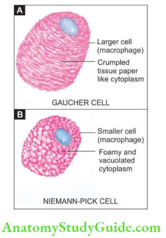 Genetic And Paediatric Diseases Gaucher Cell And Niemann Pick