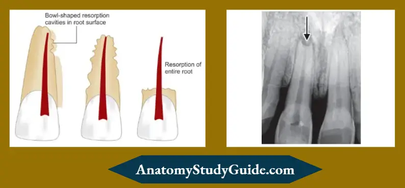 Histologic Evaluation